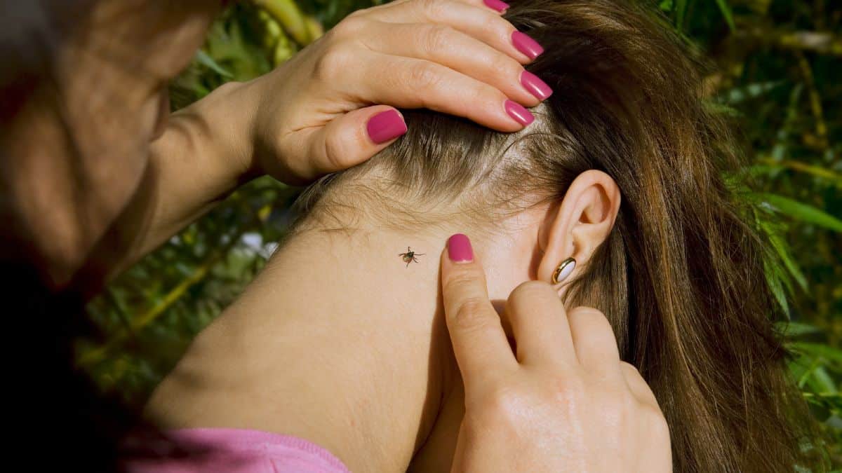 A close-up of a woman's hand pointing to a tick on another person's head amidst strands of hair.