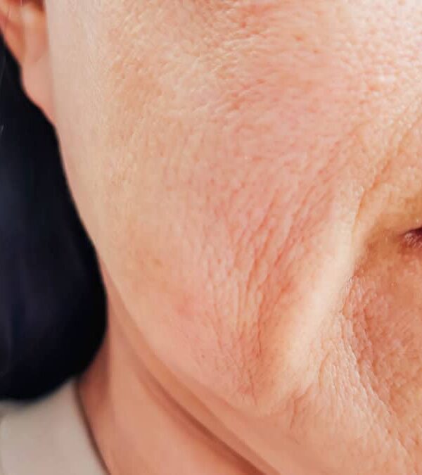 Close-up side view of a person's face showing detailed skin texture with visible wrinkles and fine lines.