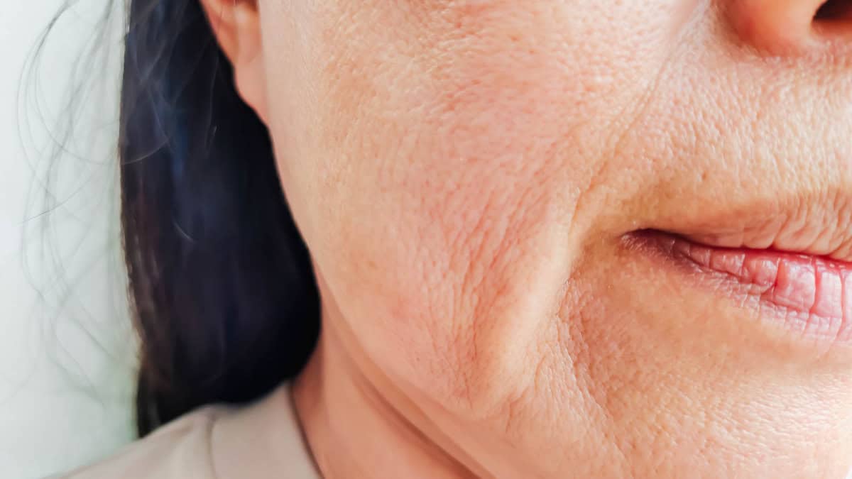 Close-up side view of a person's face showing detailed skin texture with visible wrinkles and fine lines.
